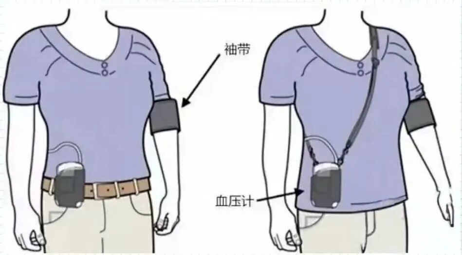 冬天血压像坐过山车？ 动态血压监测为您“画”出波动真相