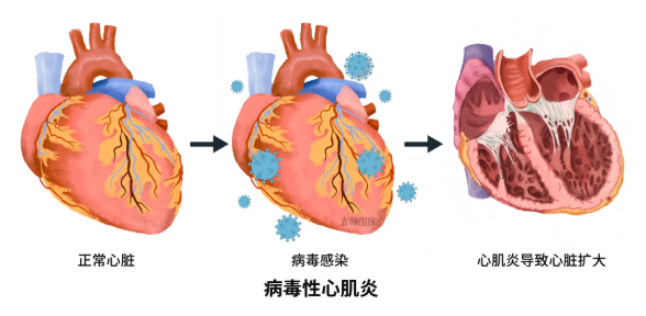 【科普】年轻人注意：这种“感冒”几小时可致命
